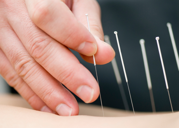 Integrative Acupuncture of Southern Nevada